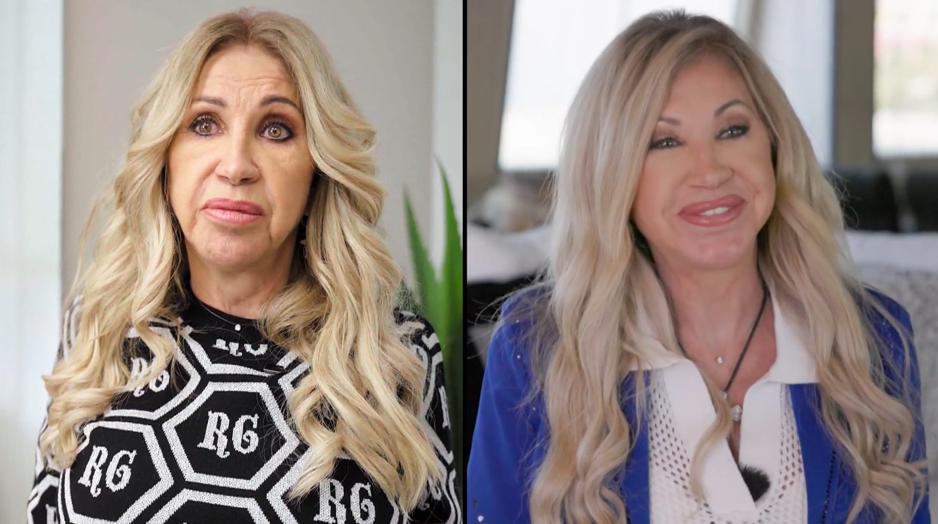 carmen geiss facelift